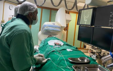 Neurorradiologistas realizam embolização de um aneurisma cerebral com stent redirecionador de fluxo por via radial